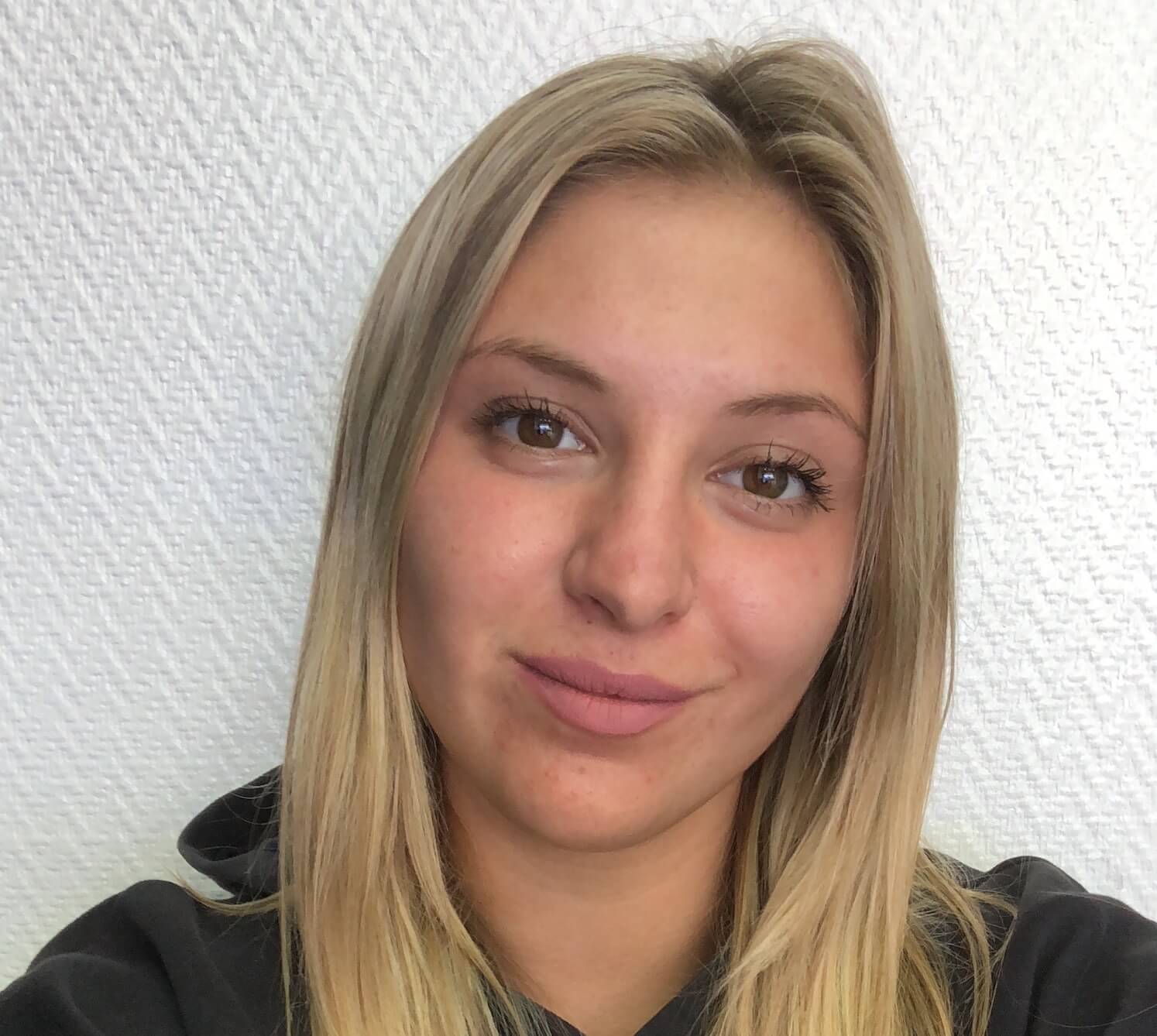 cryopoint-anna-image